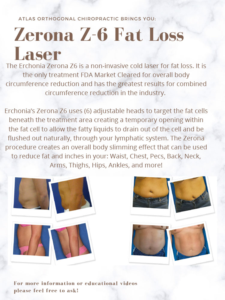 Chiropractic Irvine CA Zerona Z-6 Fat Loss Laser