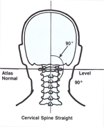 Chiropractic Irvine CA Cervical Spine Straight