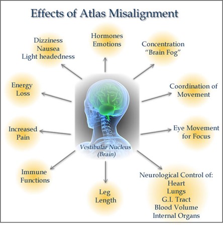 Chiropractic Irvine CA Effect Of Misalignment